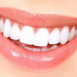How Veneers Can Improve Light Reflection for a More Youthful Appearance
