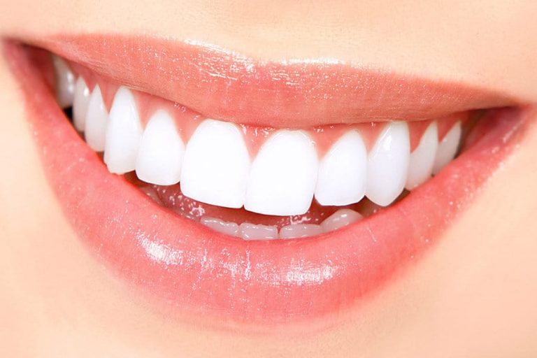 How Veneers Can Improve Light Reflection for a More Youthful Appearance